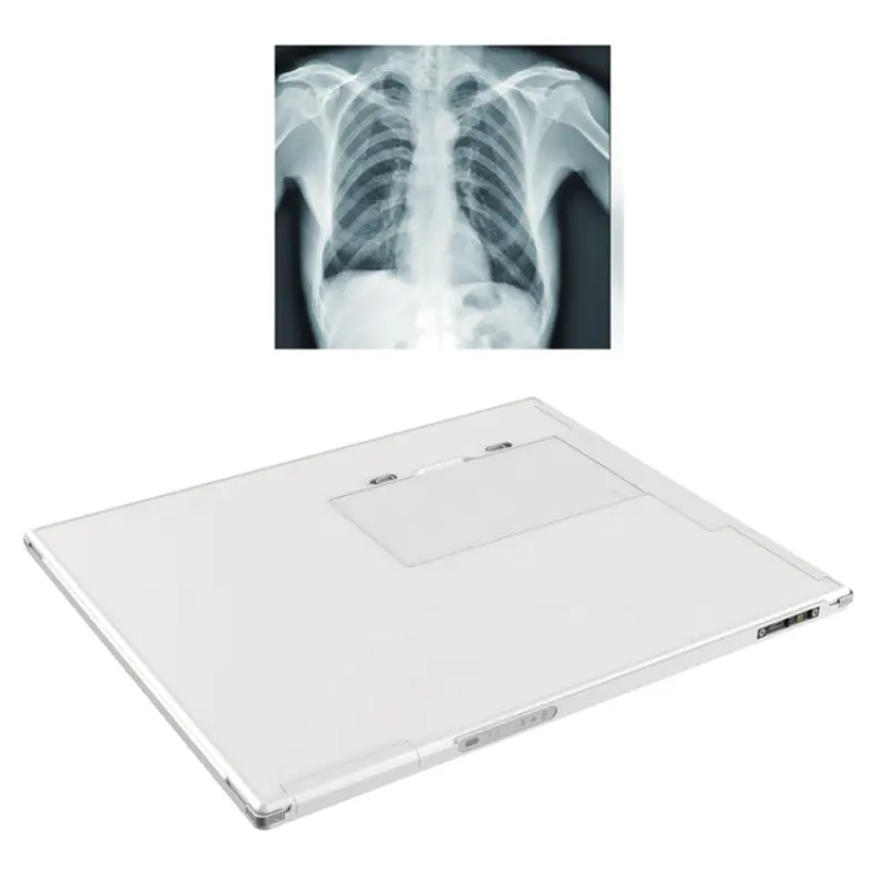 Iray DR Wireless Flat Panel Detector - 17x17 Inch Digital X-Ray Panel