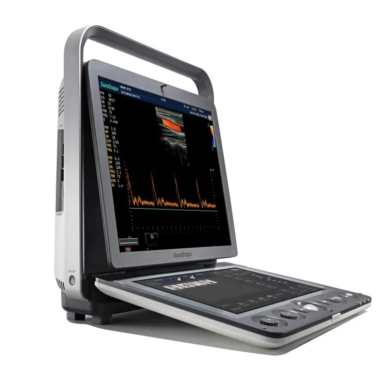SonoScape S9 portable echocardiography ultrasound machine