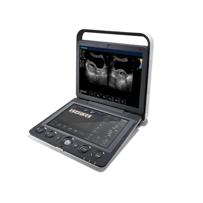 SonoScape S9 portable echocardiography ultrasound machine