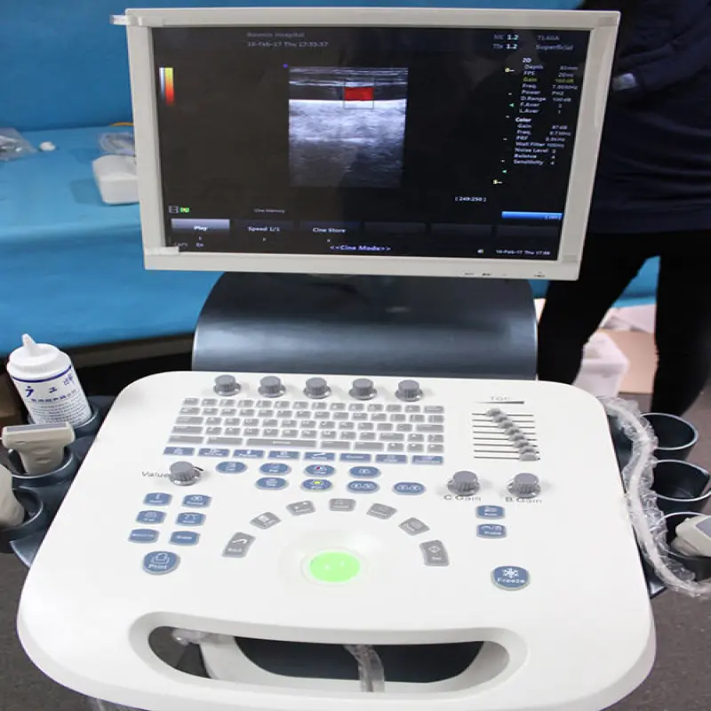 3D 4D Full Digital Trolley Doppler Ultrasound Scan Machine