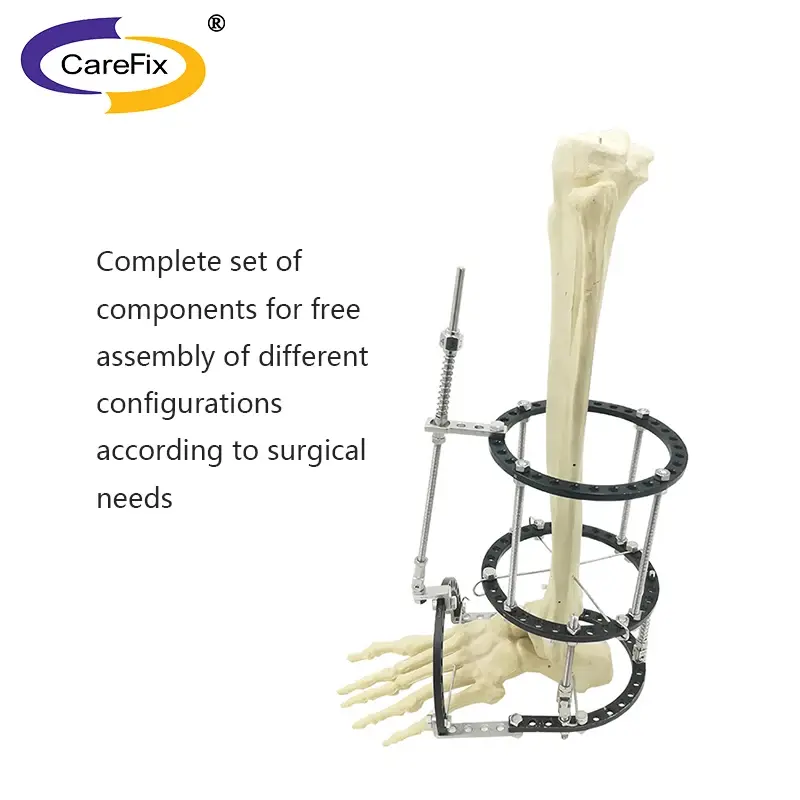 CareFix Trauma Product For Foot Orthopedic Surgical Instruments