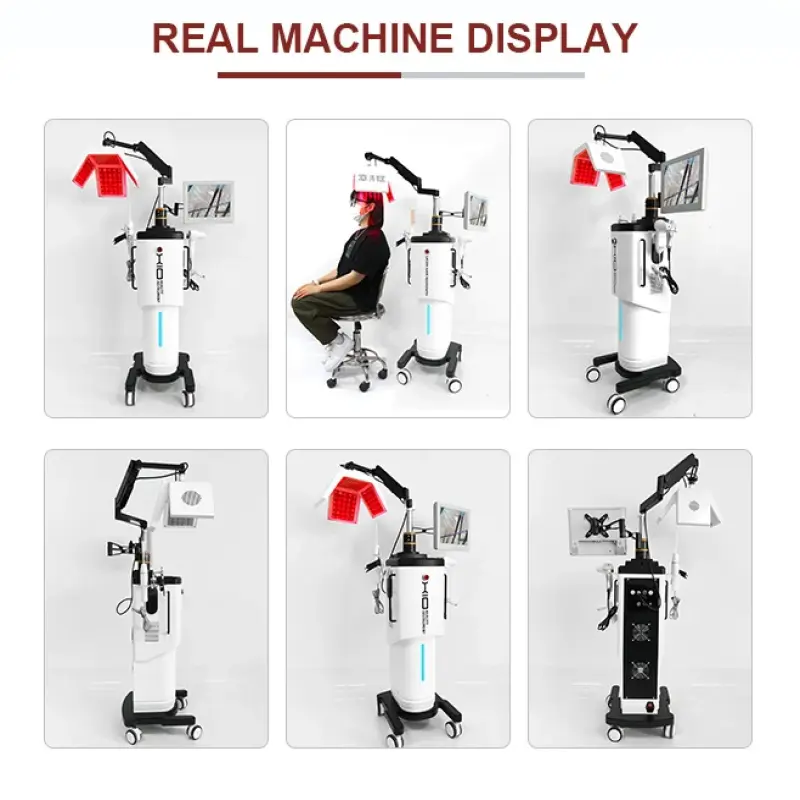 Beauty Salon Hair Loss Treatment Regrowth Machine Hair Scalp Treatment Machine With Hair Follicle Detection Analysis