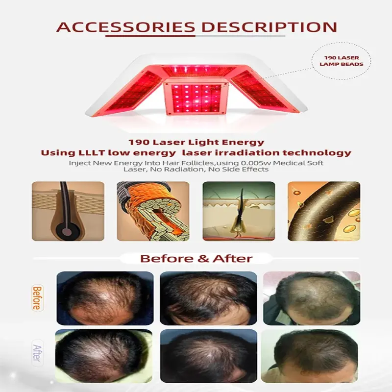 Beauty Salon Hair Loss Treatment Regrowth Machine Hair Scalp Treatment Machine With Hair Follicle Detection Analysis
