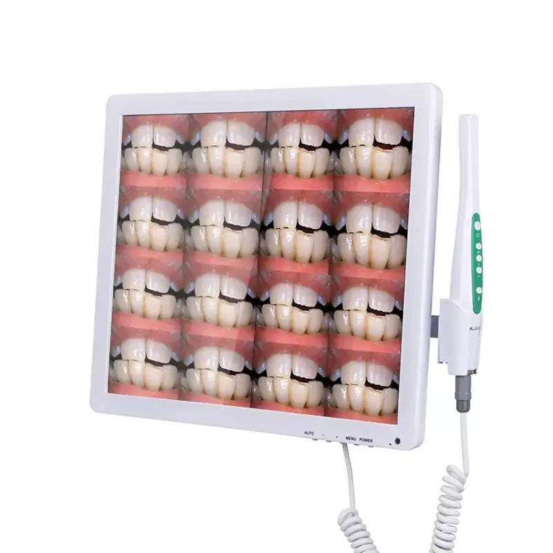 Dental Clinic Equipment Intraoral Scanner Dental Intra Oral Camera With 17 Inch Lcd Monitor