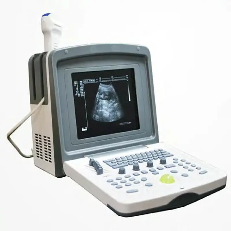 personal ultrasound machine or echographe portable ultrasound scanner