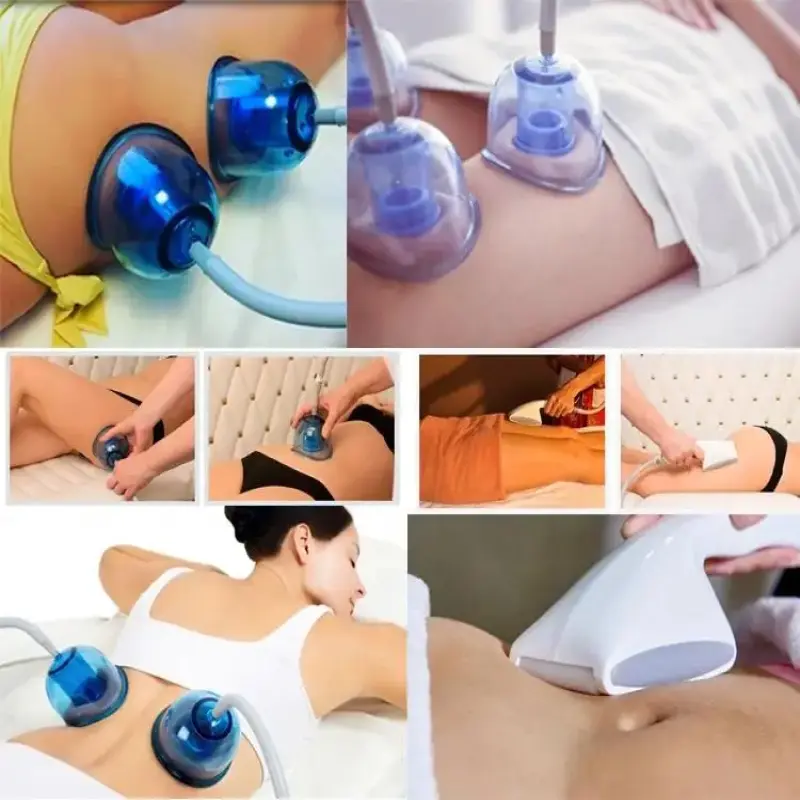 Starvac sp2 M6 vacuum cupping therapy set massager buttock vacuum butt lifting machine cups