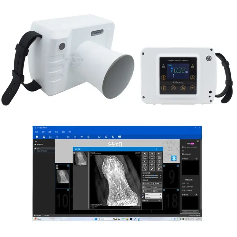 Dental X-Ray Machine with Sensor