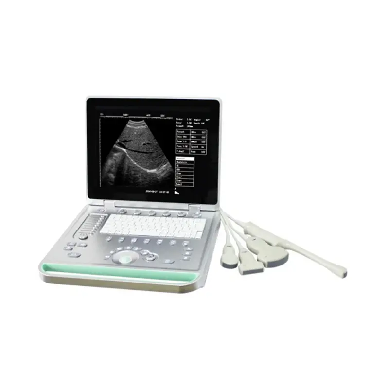 LTUB18 Promotion Portable B&amp;W Laptop ultrasound scan machine