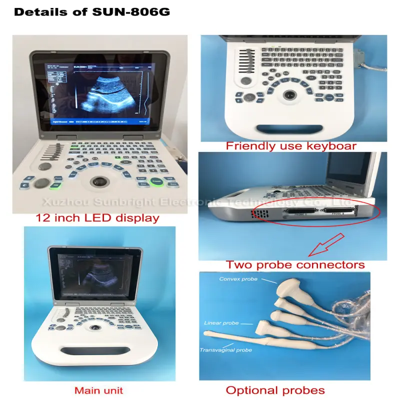 Digital measurement medical ultrasound hospital equipments
