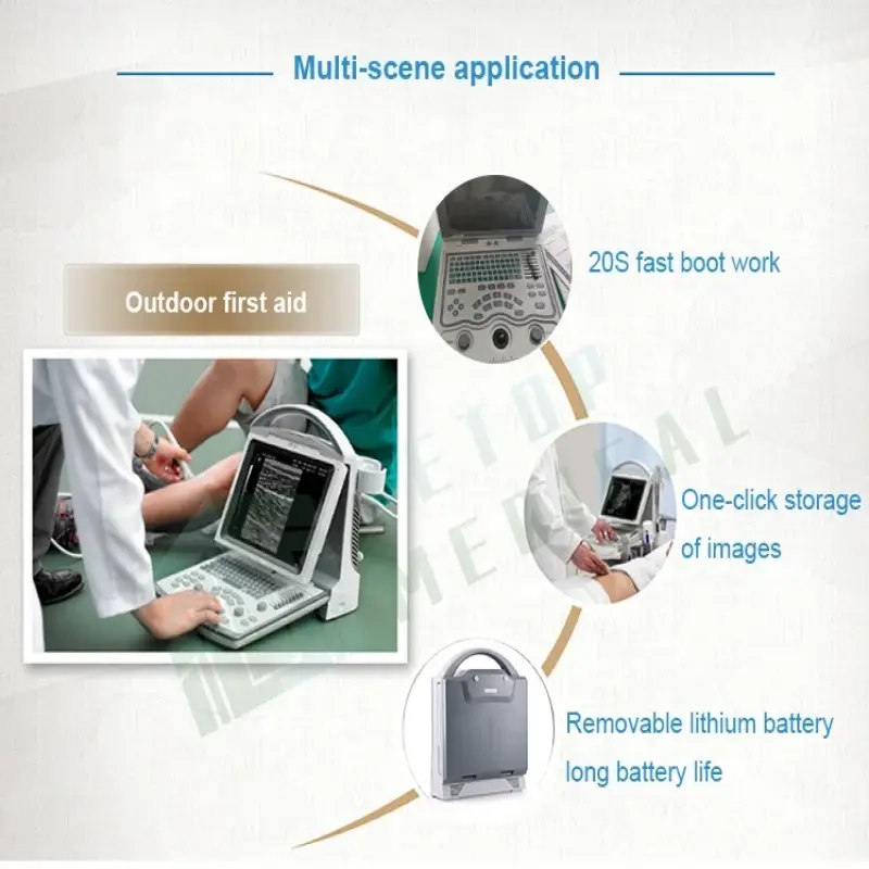 Portable Ultrasound Machine Medical Equipment Gray Scale Ultrasound Vet Ultra Skin Power Supply Hospital Equipment for Sale