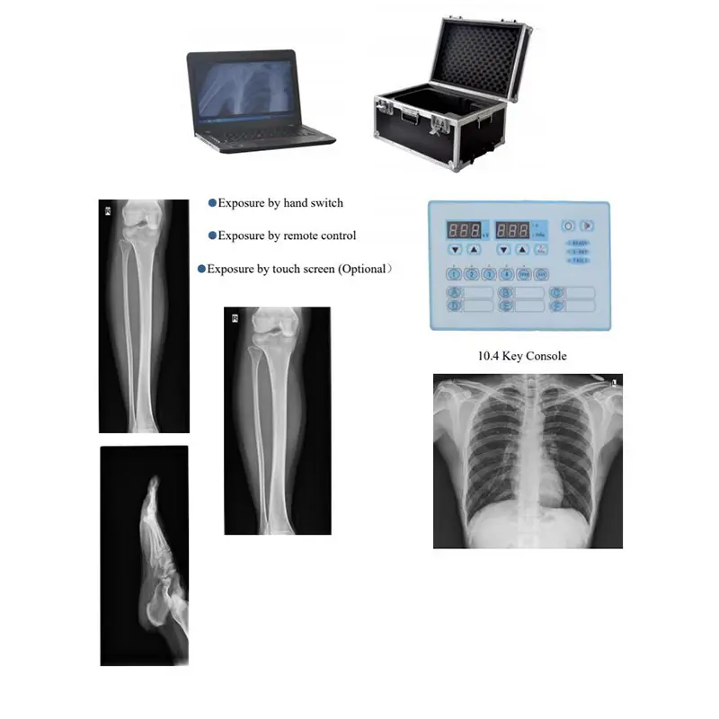 Hospital DR Flat Panel Mobile X Ray 5kw touch Screen Digital Portable X-ray Machine Equipment