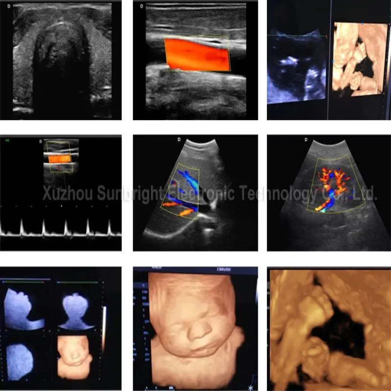 usg 4d Cardiac heart surgery professional color doppler ultrasound machine 3D 4D medical sonogram CE ultrasound color