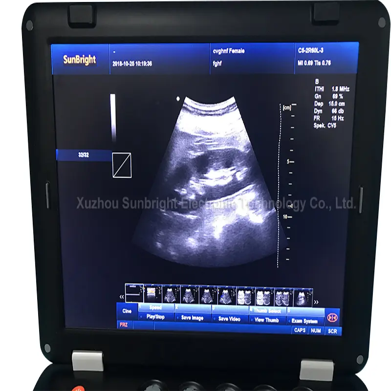 usg 4d Cardiac heart surgery professional color doppler ultrasound machine 3D 4D medical sonogram CE ultrasound color