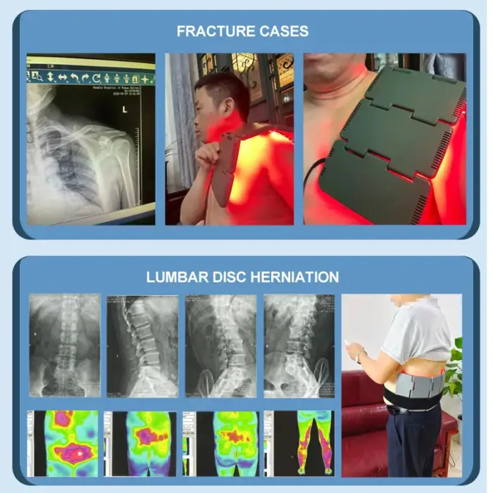 Lastek Therapi Cold Laser Pain Relief LLLT Infrared Light Wound Healing Machine Medical Health Care Physical Therapy Equipment