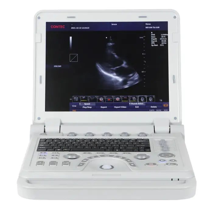 CONTEC CMS1700B-VET color doppler ultrasound machine veterinary ultrasound system