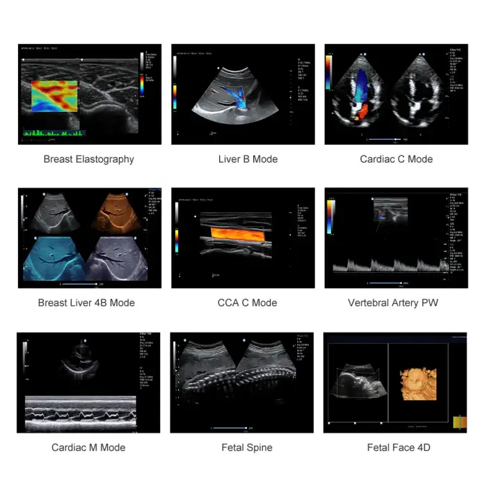 Medical veterinary ultrasound machine for vet pregnancy scan