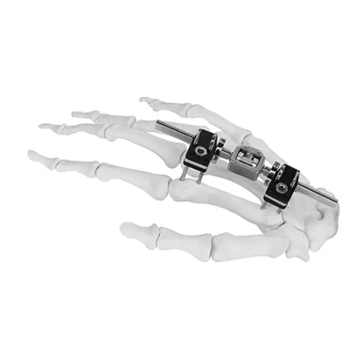 High quality Jinlu Medical orthopedic implants AL Mini fixator joint motion type instrument kit for Metacarpal bone