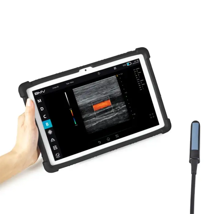 BestScan S5 Go WIFI Connect Mini Handheld Portable Ultrasound with Rectal Linear Probe