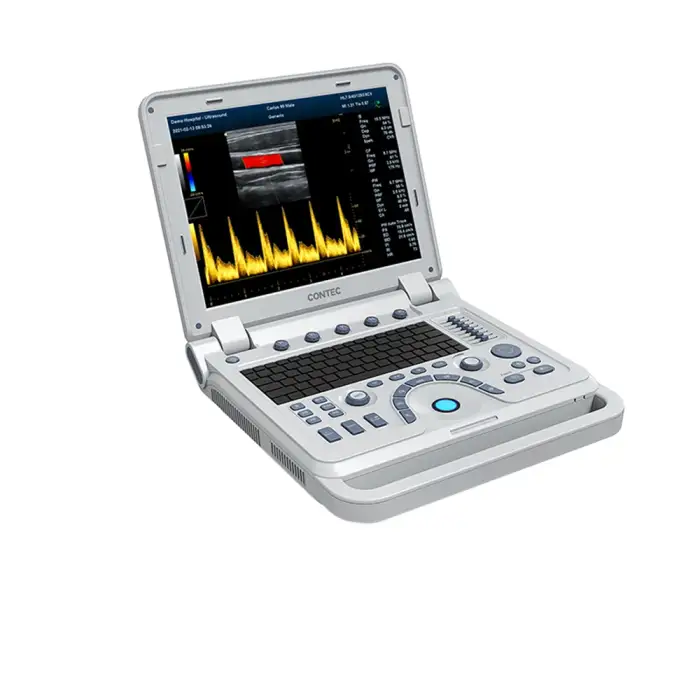 CONTEC CMS1700B abdominal obstetric urology cardiac pediatric gynecology peripheral vascular ultrasound color doppler