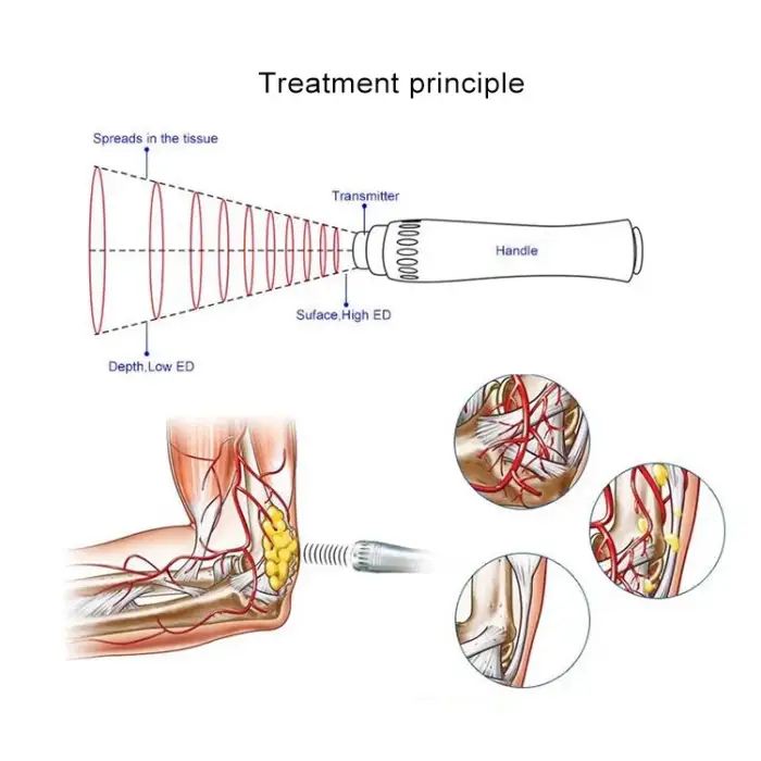 21Hz Medical Electromagnetic Physiotherapy Shock Wave Device