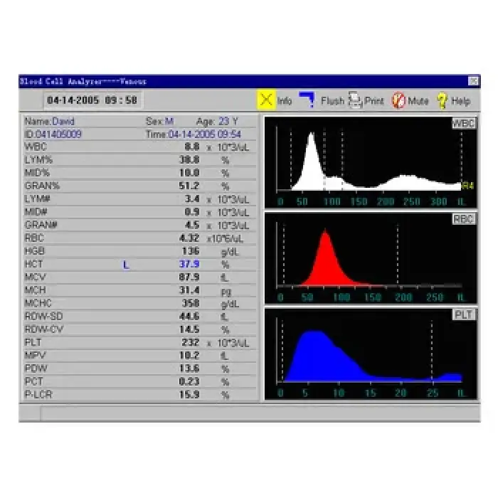 CBC 3 Part Haematology Analyser Fully Automated Hematology Analyzer Price Blood Analysis System Open Reagent Class II