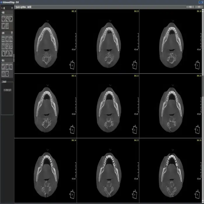 Used HDX-DENTRI-S panoramic dental x ray machine  3d CBCT