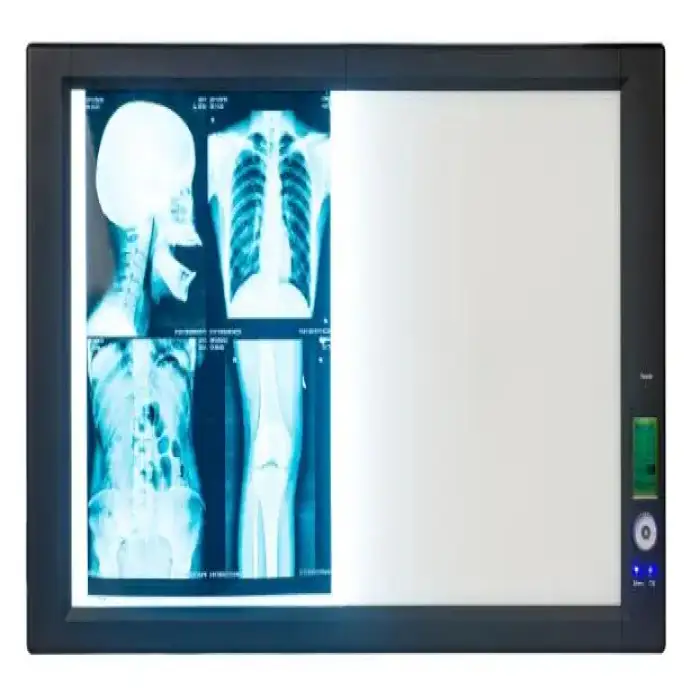 Medical LED x-ray film light box medical led x ray negatoscope