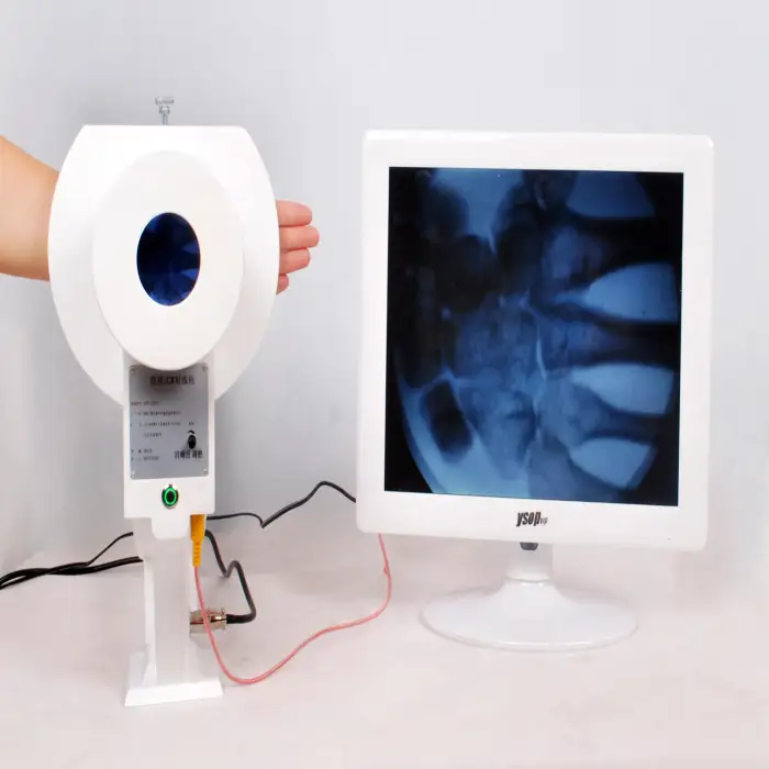 digital floroscope x ray machine medical industrial Digital X-ray Machine