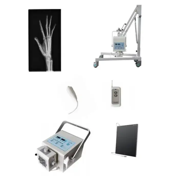 Medical Radiography X-ray Machine High Frequency Portable X ray Medical Device