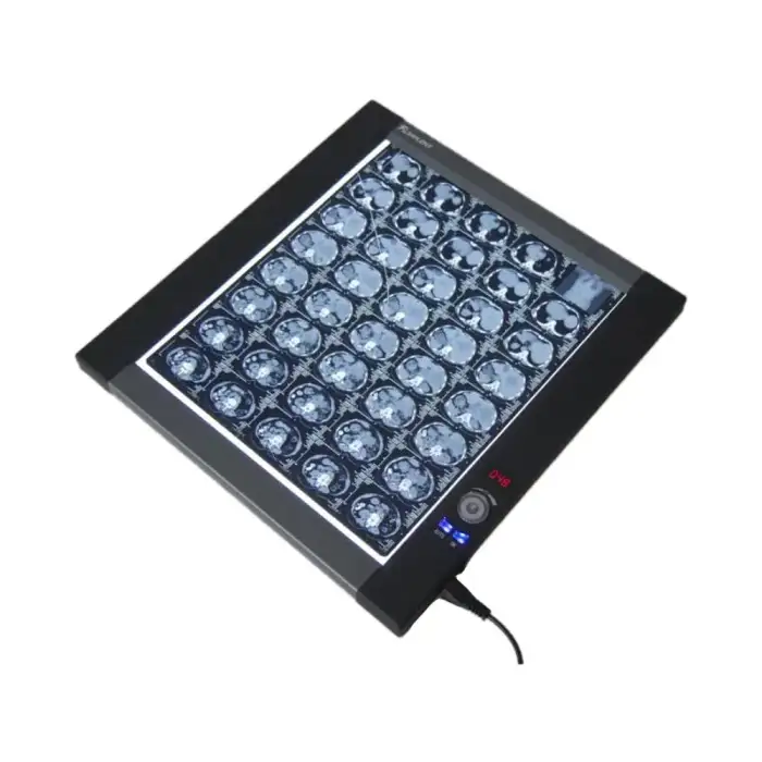 Adjustable Medical LED X Ray Imaging Film Viewer view box xray viewer