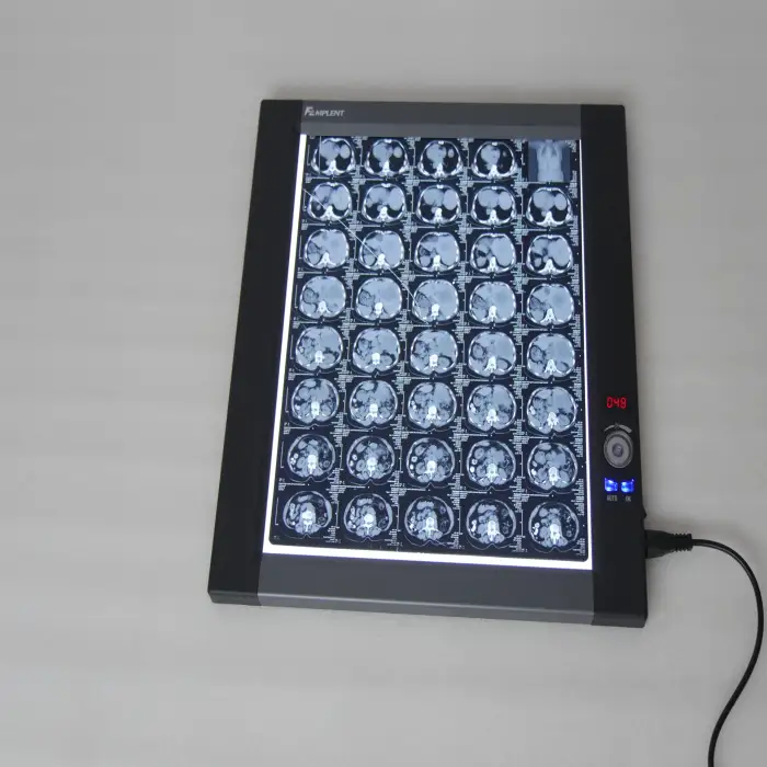 Adjustable Medical LED X Ray Imaging Film Viewer view box xray viewer