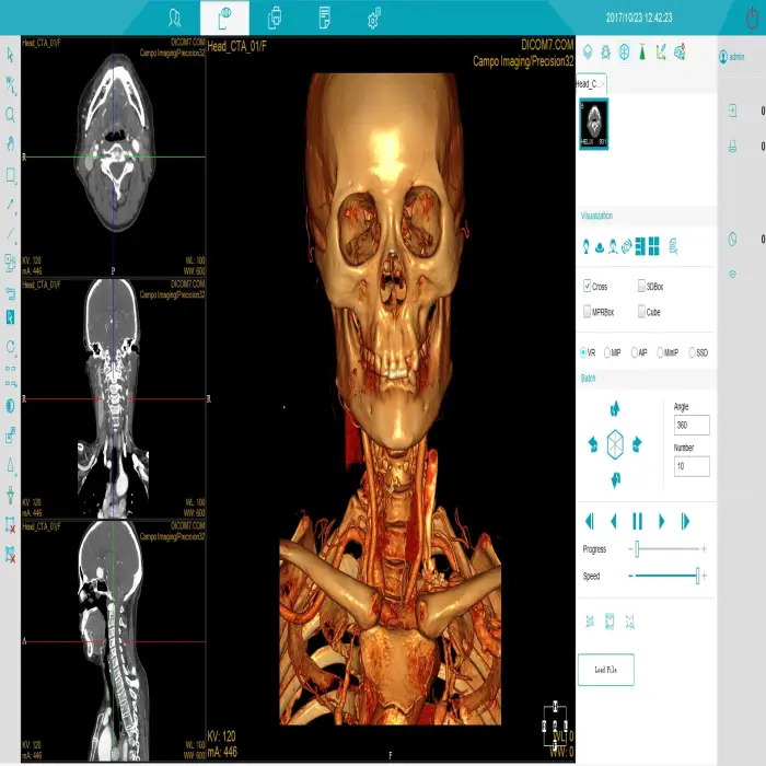 MRI CT scanner 32 slice spiral ct X RAY scan machine for hospital