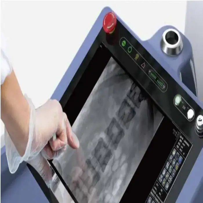 25kW diagnostic radiology Digital X-Ray Machine