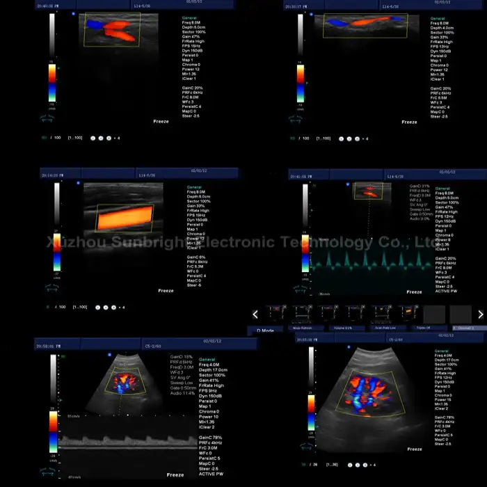 Modern Design Medical Ultrasound Instruments Scanner Other Ultrasonic &amp; Electronic Equipment