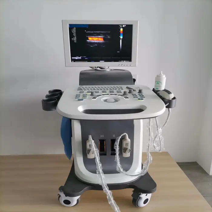 LTUB66 Medical Ultrasound Instruments Usb 4D Trolley Urology Heart Cardiac USG Machine For Ultrasound