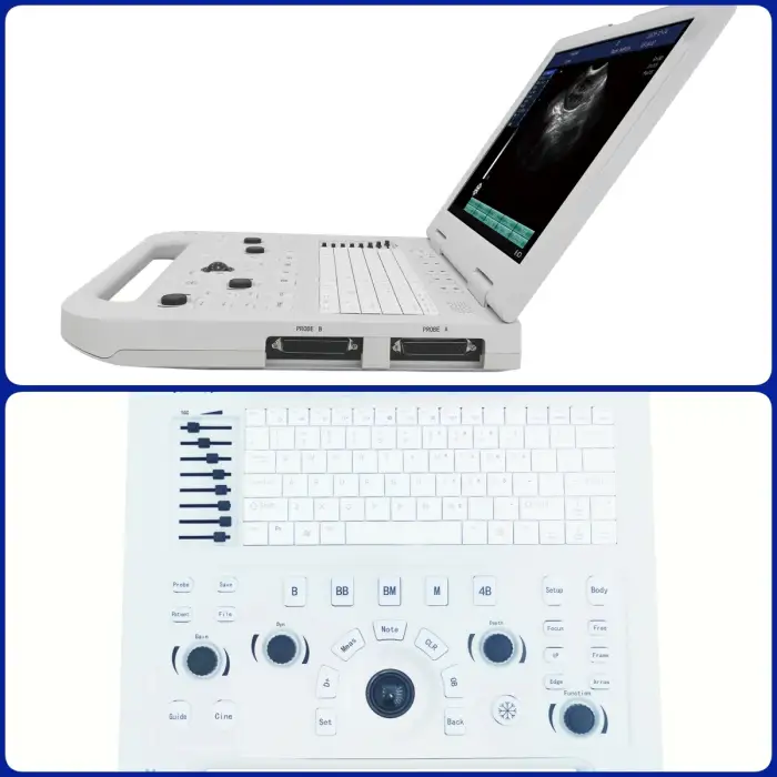 Heart Diagnostic Machine System Black and White Ultrasound Human Pregnancy Ultrasound Machine Medical Ultrasound