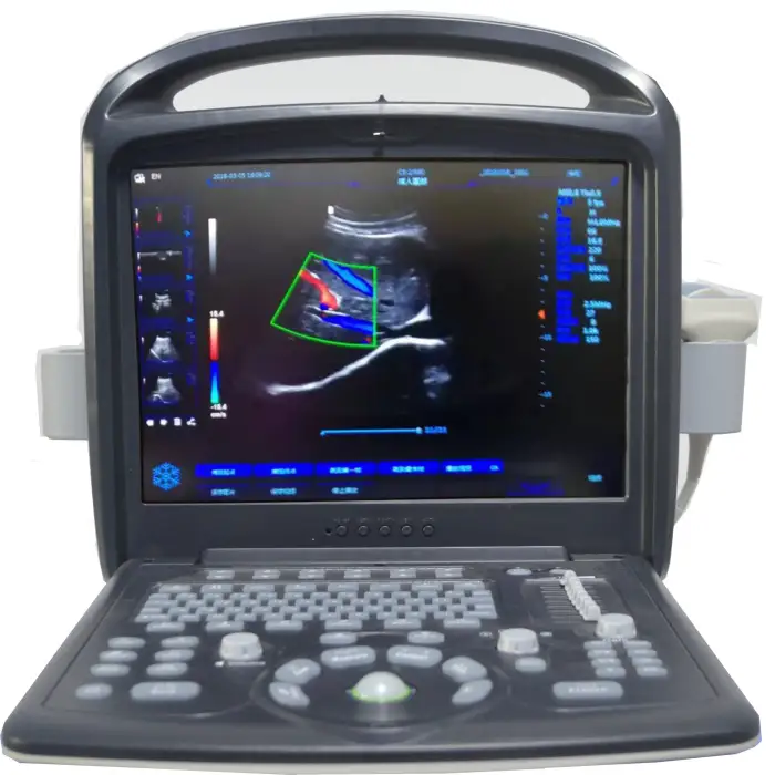 Heart Ultrasound Production Unit Is Known For Its Use Of Advanced Real-Time 4D Doppler Systems