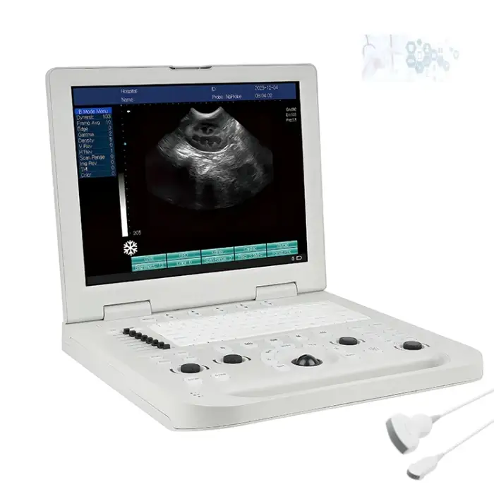 Heart Diagnostic Machine System Black and White Ultrasound Human Pregnancy Ultrasound Machine Medical Ultrasound