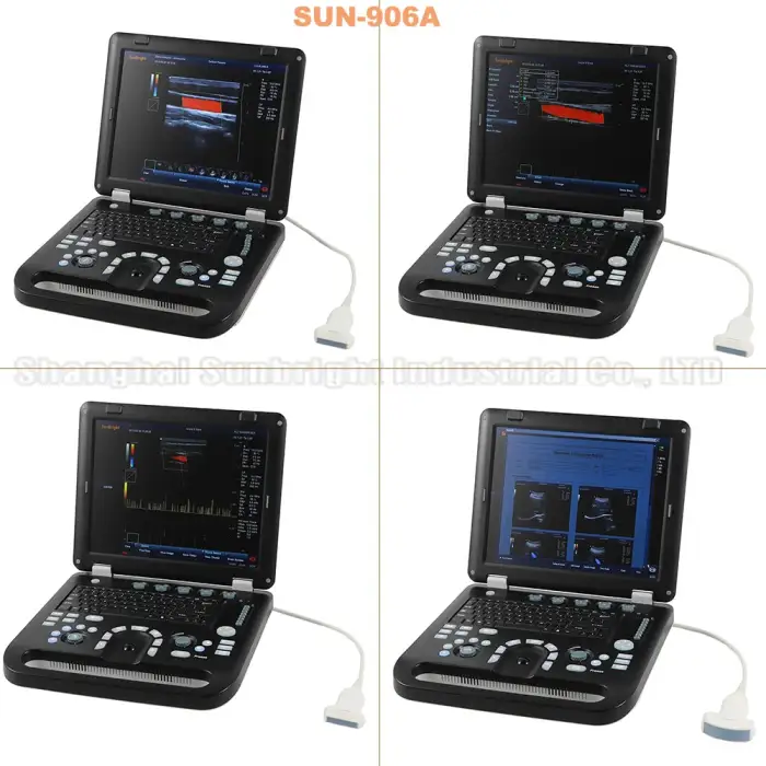 medical equipment large Screen Diagnostic Ultrasound machine Trolley Color Doppler Ultrasound Scan