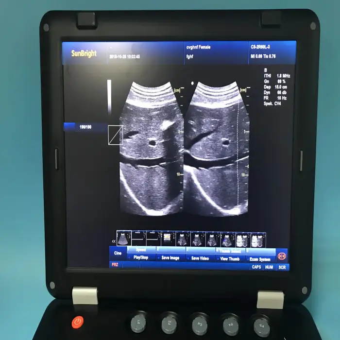 medical equipment large Screen Diagnostic Ultrasound machine Trolley Color Doppler Ultrasound Scan