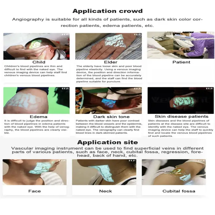 infrared blood vessel vein finder or vein detector