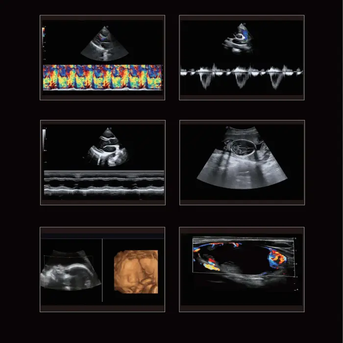 Medical Equipment Factory High Quality 4d Portable Color Doppler Ultrasound System Machine With Cradiac Probe Price