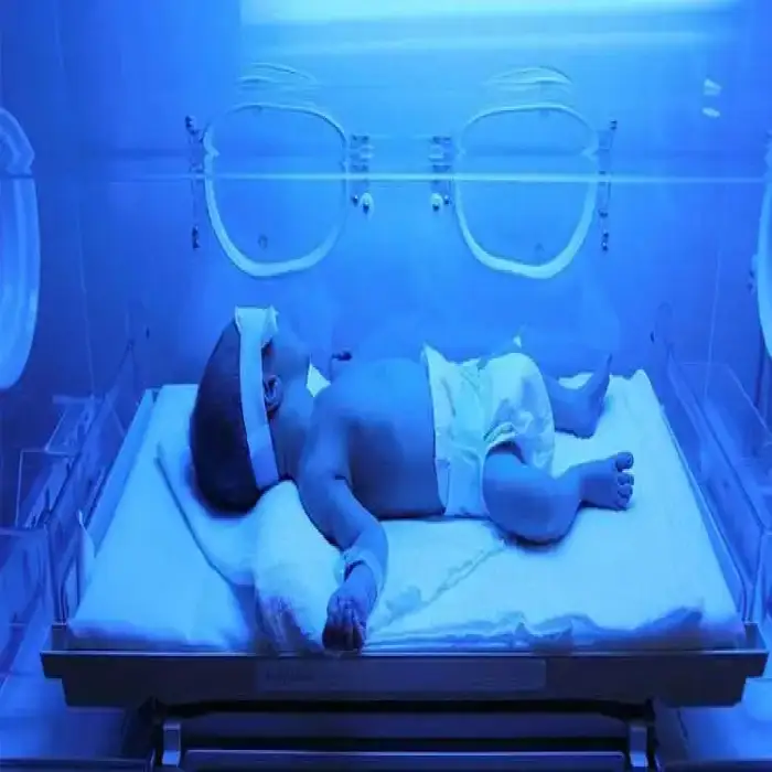 NBB2 Neonate Bilirubin Phototherapy Equipment Neonatal Jaundice Treatment Fluorescent lamp as light source