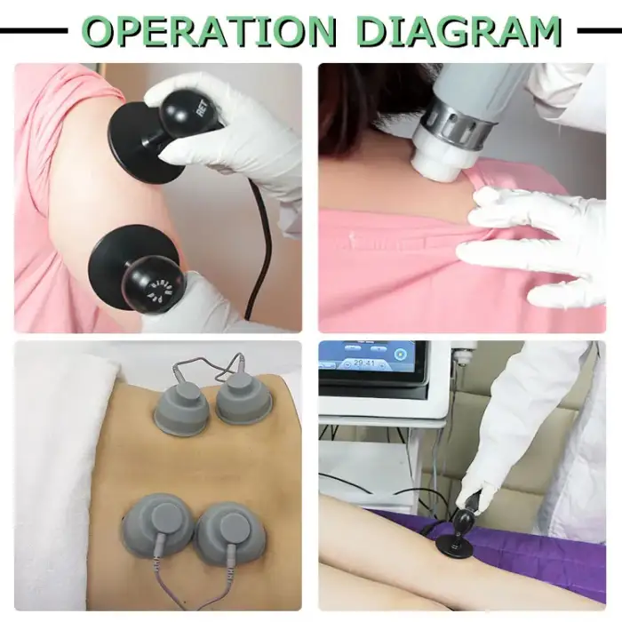 Popular Multi-function Physiotherapy Medical Equipment for soft tissue pain in muscle