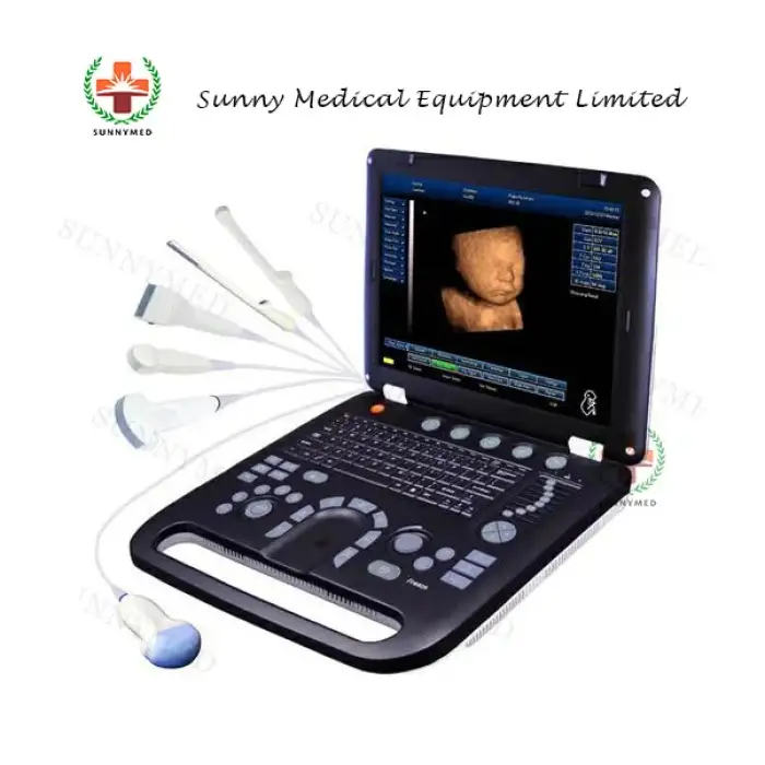 SY-A039  Guangzhou USG 4D ultrasound machine price of Medical Equipment