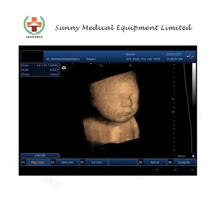 SY-A039  Guangzhou USG 4D ultrasound machine price of Medical Equipment