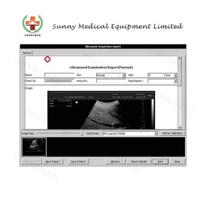 SY-A039  Guangzhou USG 4D ultrasound machine price of Medical Equipment