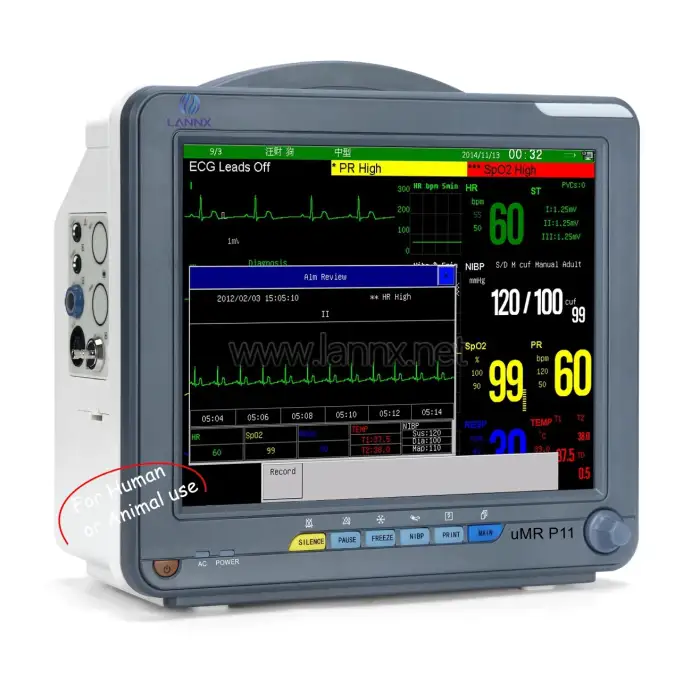 Rayman multi-parameter medical monitor portable ICU hospital monitor ECG machine Cardiac monitor signs vitals