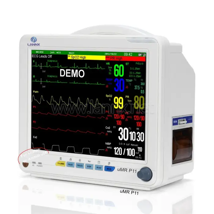 Rayman multi-parameter medical monitor portable ICU hospital monitor ECG machine Cardiac monitor signs vitals