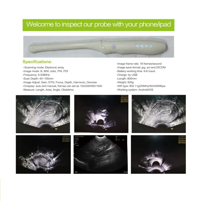 SY-AVL_vet  Portable Veterinary sonar Big Animal transrectal series wireless probe type ultrasound scanner